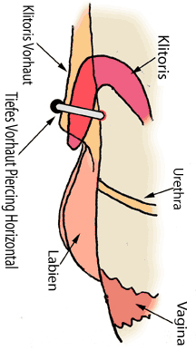 tief gestochenes Klitoriscorhaut Piercing, stimuliert die Klitoris von hinten