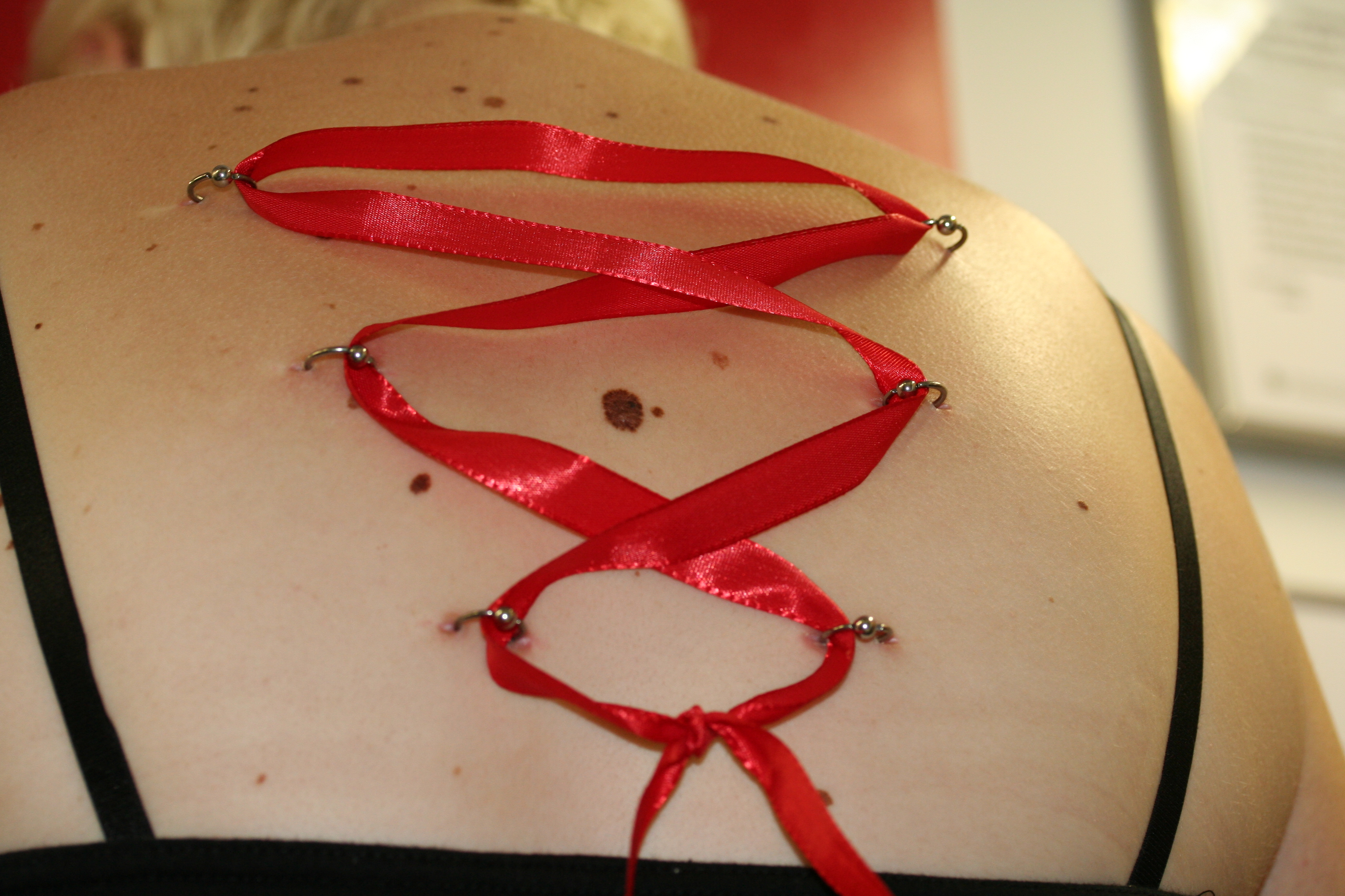 Korsett-Piercing am Rücken mit 3 BCR Ringen und rotem Band